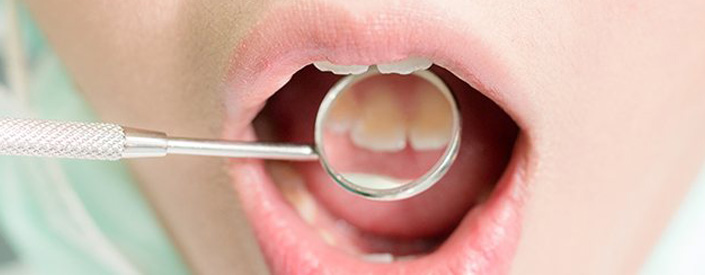 CHECK FOR CAVITIES