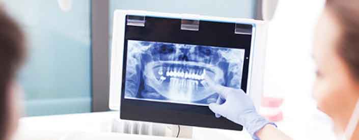 digital-x-ray