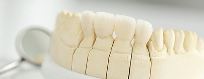same-day-dental-crowns-phoenix-az