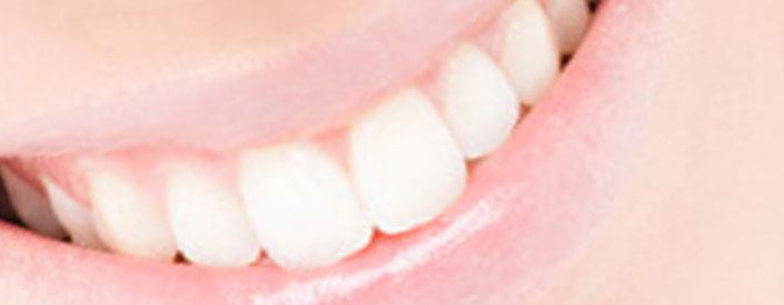 phoenix-teeth-whitening