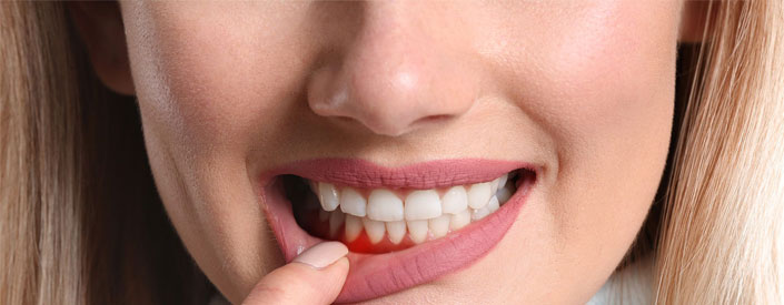 gum-disease-phoenix