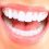 Top Tips for Whiter Teeth in Phoenix